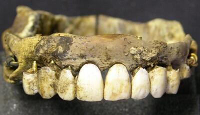 ساخت دندان مصنوعی از عضوی چندش‌آور در بدن سربازان مرده!