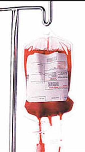 پایگاه انتقال خون به چه گروه‌های خونی نیاز دارد