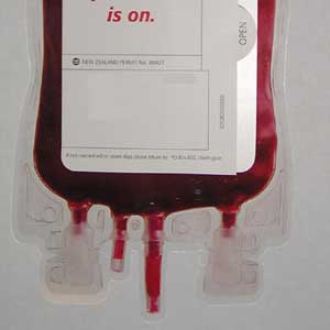 آیا اهدای خون ایمن است؟