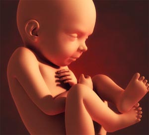 سقط جنین تروماتیک