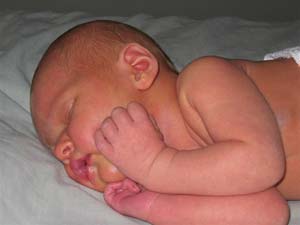 مراقبت از بند ناف در نوزاد تازه متولد شده