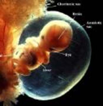 تعیین جنسیت و تشخیص بیماری ژنتیکی جنین قبل از تولد