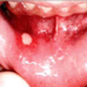 تشخیص و بیماریهای دهان