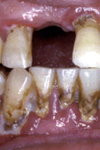 جداسازی و بررسی اکتینومایسزهای دهانی از بیماران مبتلا به بیماری پریودنتال