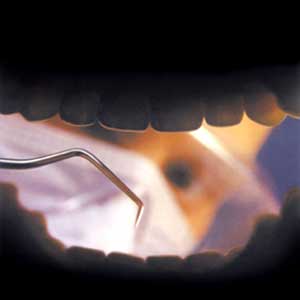 پروتزها در دندانپزشکی