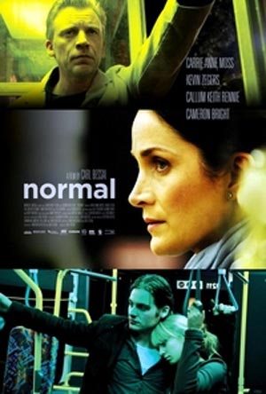 طبیعی / عادی Normal
