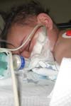بررسی سطح سرمی روی در کودکان بستری شده به علت پنومونی و گاستروآنتریت در زاهدان