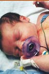 بررسی نتایج اعمال جراحی بر روی ناهنجاریهای مادرزادی قلب در کودکان بستری در بیمارستان شهید رجائی طی سالهای ۱۳۷۵-۱۳۶۶