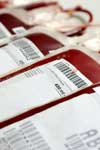شیوع HBcAb در میان اهداکنندگان بار اول HBsAg منفی مراجعه کننده به پایگاه‌های انتقال خون خرم‌آباد و بروجرد