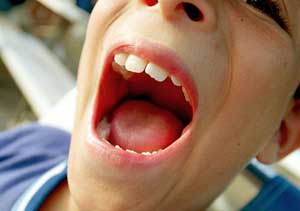 نقش دهان در سلامت بدن
