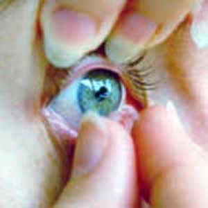 جایگاه لنزهای چشمی در درمان و زیبایی