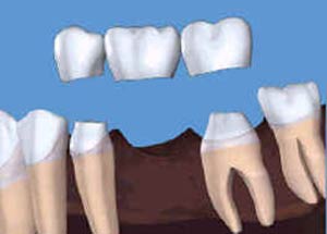 آناتومی دندان و شناخت سطوح آن