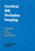Cerebral MR perfusion imaging