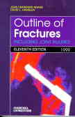 Outline Of Fractures: Including Joint Injuries