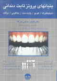 بنیانهای پروتز ثابت دندانی: روکش‌ها و پلهای دندانپزشکی