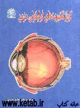 کونژنکتیویت‌های فولیکولی مزمن (تراخم و علل قرمزی، خارش و سوزش چشم)