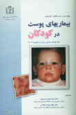 بیماریهای پوست در کودکان (طب کودکان نلسون)