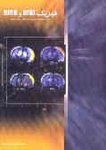 تصویرنگاری تشدید مغناطیسی (MRI) و فیزیک تشدید مغناطیسی هسته‌ای (NMR) 'جهت استفاده ...'