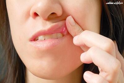 بیماری‌های دهان می‌تواند نشان دهنده چه سرطان‌هایی باشد؟