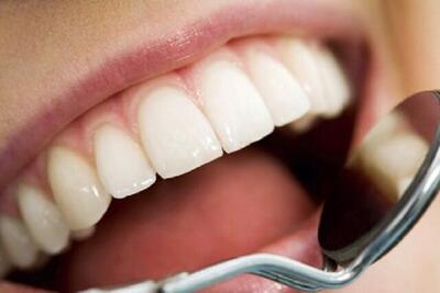 آزمایش بالینی اولین داروی رشد مجدد دندان‌ در ژاپن