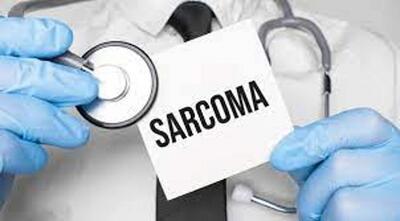 علایم سرطان سارکوم و عوامل موثر در ابتلا به سارکوم