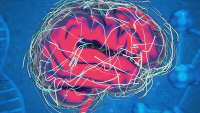 امید جدید برای درمان آلزایمر: تحریک 40 هرتزی مغز، پلاک‌های آمیلوئید را دفع می‌کند!