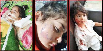 حمله مرگبار سگ ولگرد به 2 خواهر دوقلو در نکا / عسل کوچولو تسلیم مرگ شد +عکس و جزییات تلخ