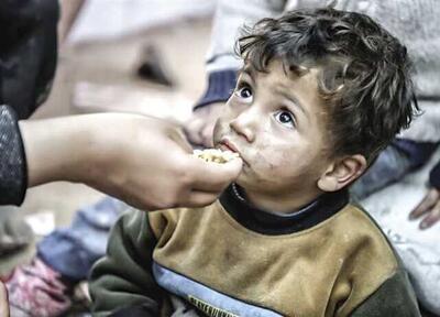 افشاگری پزشک عمانی از وضعیت تغذیه کودکان در غزه