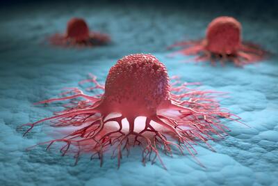 کشف یک درمان ابتکاری جدید برای سرطان