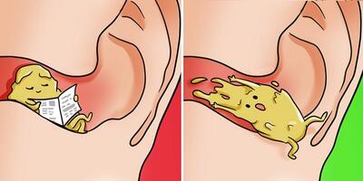چند راهکار ساده و موثر برای حفظ تمیزی گوش‌ها