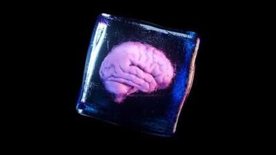 سرمازیستی؛ ماجرای واقعی مغز یک پزشک که شبیه فیلم های علمی تخیلی است!/ تصاویر