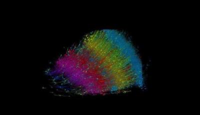 محققان گوگل، نقشه‌ای با جزئیات بی‌سابقه از مغز انسان ساختند | خبرگزاری بین المللی شفقنا