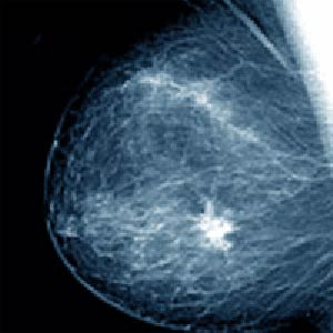 بیشترین فایده را از ماموگرافی ببرید