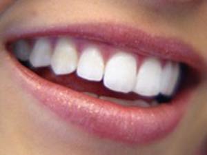 دندانها آینه تمام نمای بدن هستند
