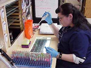 آزمایش سرولوژی برای تشخیص تب مالت