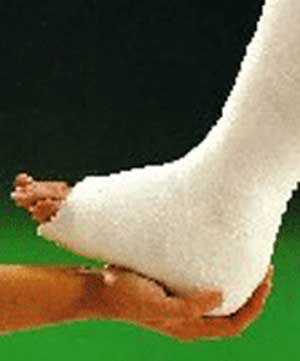 سودمندی گچ‌های ویژه پا برای تسریع در بهبود زخم‌های پای مبتلایان به دیابت