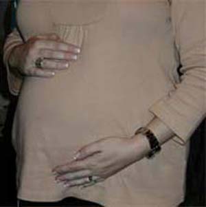 چاقی در زنان باردار، خطر ابتلا به مسمویت حاملگی را افزایش می‌دهد