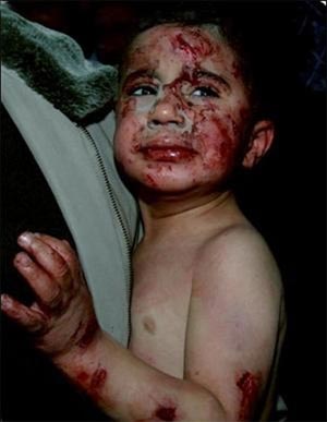 تحیل گاردین از تراژدی انسانی در فلسطین