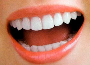 روش سفید کردن دندانها