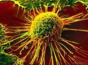 « سرطان » و روش های نوین درمان