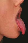 بررسی شیوع و علل ایجاد کننده بوی بد دهان