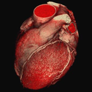 اثر سیستم ایمنی در درمان نارسایی قلبی