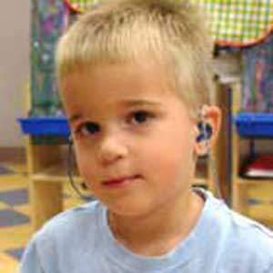 علل کم شنوایی کودکان