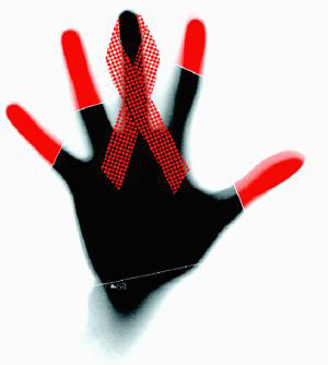 پیشروی بیماری ایدز در بدن