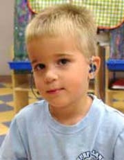 درمان کودکان کم شنوا را از دست ندهید