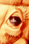 بیماری چشم صورتی در گاو
