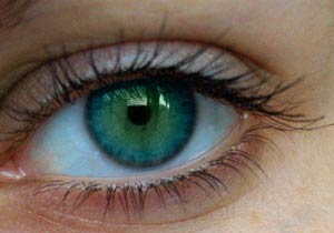 بیماریهای چشمی کراتوکونوس