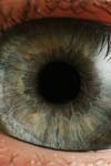 مقایسه طول محوری چشم در بیماران مبتلا به رتینوپاتی و افراد غیر دیابتی