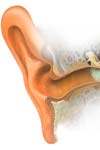نتایج عملی بازسازی شنوایی در نظامیان مراجعه کننده به بیمارستان بقیه اله (عج)
