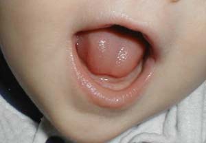 کودک و بهداشت دندان